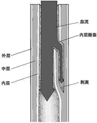 в㶯