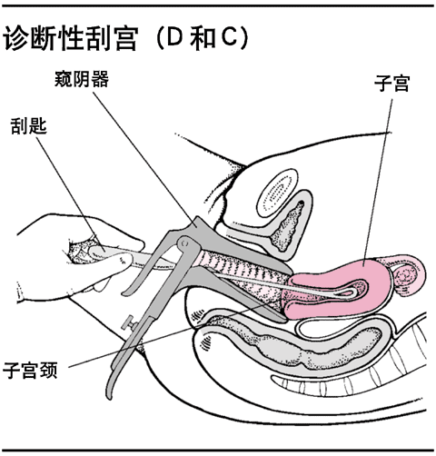 ԹιDC