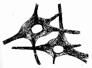 神经元银染色,示神经原纤维